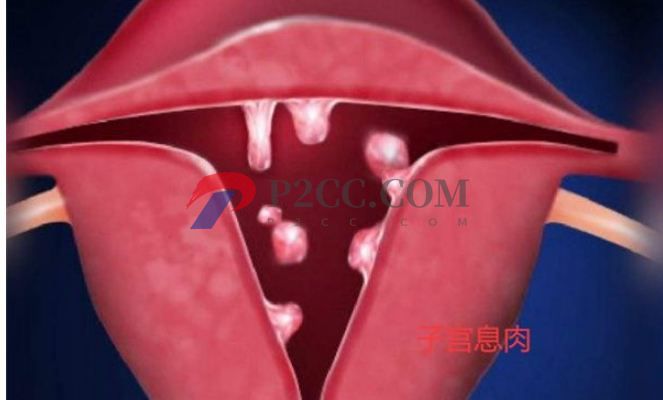 排卵期性腹痛和出血是怎么回事，需不需要治療？(圖2)